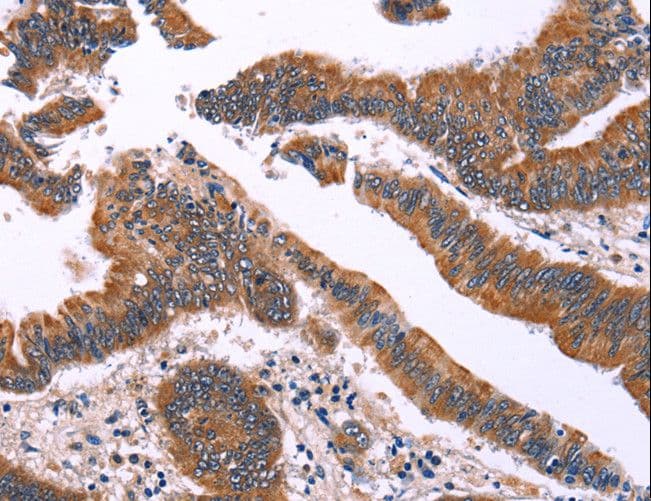Polyclonal Rabbit anti-Human SIMPL / IRAK1BP1 Antibody (IHC, WB)