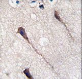 Polyclonal Rabbit anti-Human PUM1 Antibody (Tyr83, IHC, WB)