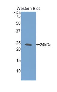 GSS / Glutathione Synthetase Antibody (aa270-474, FITC)
