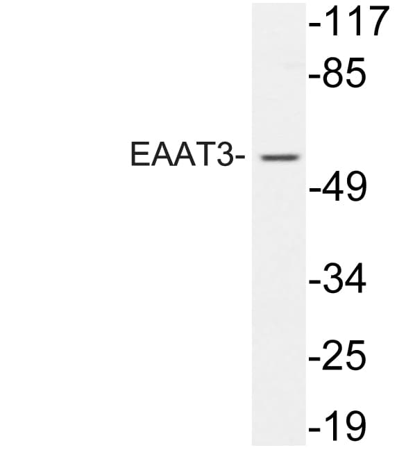 Polyclonal Rabbit anti-Human SLC1A1 / EAAT3 Antibody (aa122-171, WB)