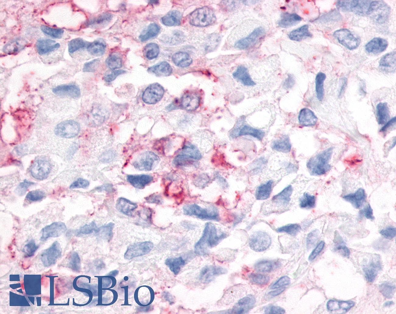 PathPlus™ Polyclonal Rabbit anti-Human ESRRG / ERR Gamma Antibody (N-Terminus, IHC)
