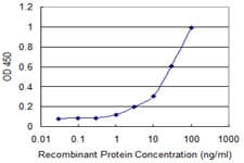 CD79B / CD79 Beta Antibody (clone 4E10-2A10)