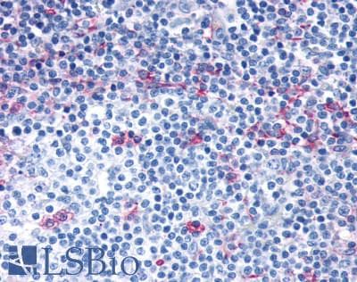 PathPlus™ CCR7 Antibody (C-Terminus)