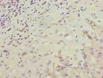 OR2H1 Antibody