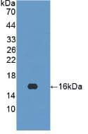 Human IFN Gamma / Interferon Gamma Protein (Recombinant His, N-Terminal)