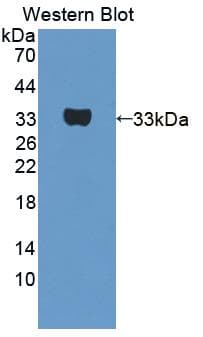 UTRN / Utrophin Antibody (aa1-252)