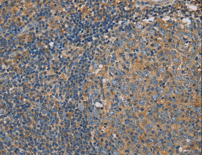 CLIC1 / NCC27 Antibody