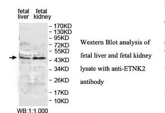 IHC-plus™ ETNK2 Antibody (aa203-385)