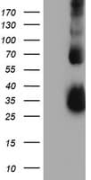 TIMP2 Antibody (clone OTI1C4)