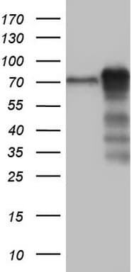 MTDH / Metadherin Antibody (aa70-582, clone OTI1B6)