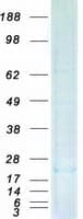 Human DUSP23 Protein (Recombinant Myc-DDK (Flag))