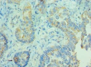 MDH / MDH2 Antibody (aa59-338)