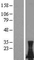 LIMD2 Protein (Over-Expression Lysate Myc-DDK (Flag))