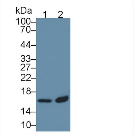 TBCA Antibody (aa2-108, Biotin)