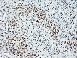 ERCC1 Antibody (clone 2.00E+12, Carrier-free)