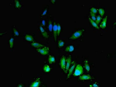CDA / Cytidine Deaminase Antibody