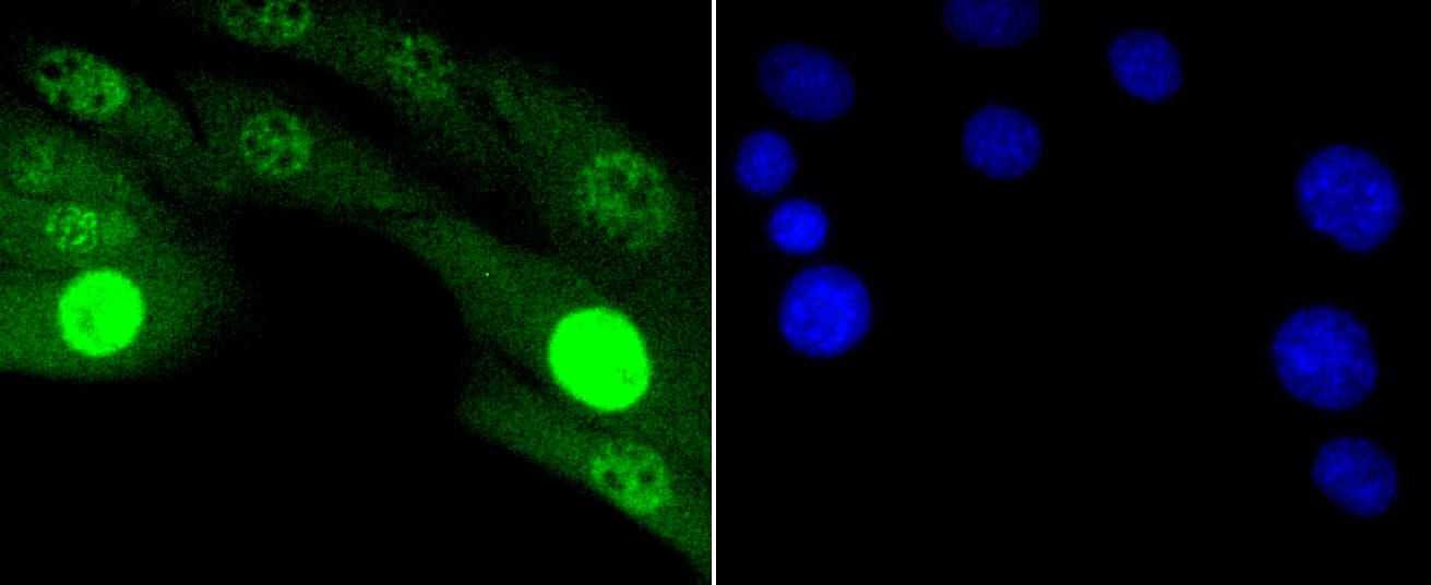 JNK1+2+3 Antibody (JNK1 phospho-Thr183 and JNK2 pThr183 and JNK3 pThr221)