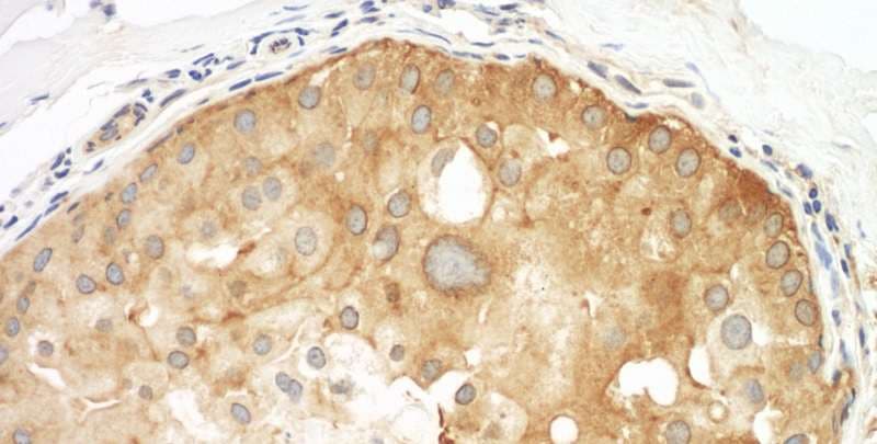 SEPT9 / Septin 9 Antibody (aa100-150)