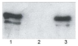 SQSTM1 Antibody