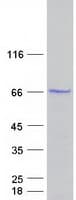 Human PDLIM5 / LIM Protein (Recombinant Myc-DDK (Flag))