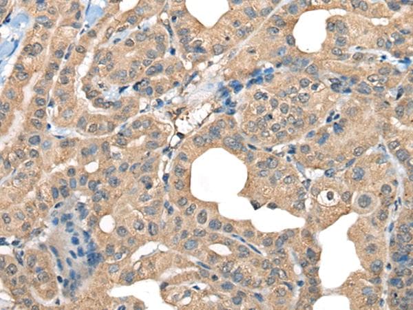 CABP5 Antibody