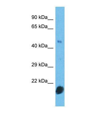 CNTD2 Antibody (aa45-94)
