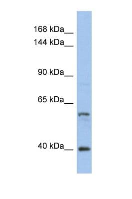 NCOA2 / TIF2 Antibody (aa175-224)