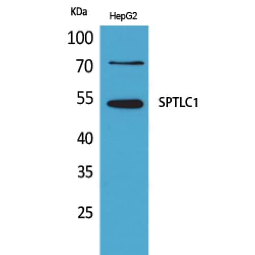 SPTLC1 / HSN1 Antibody (411-460 aa, C-terminal)