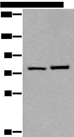 RIPK1 / RIP Antibody