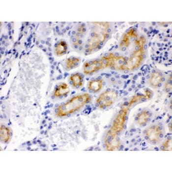 CYP24 / CYP24A1 Antibody (aa153-514)