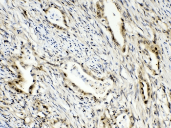 RANBP1 Antibody