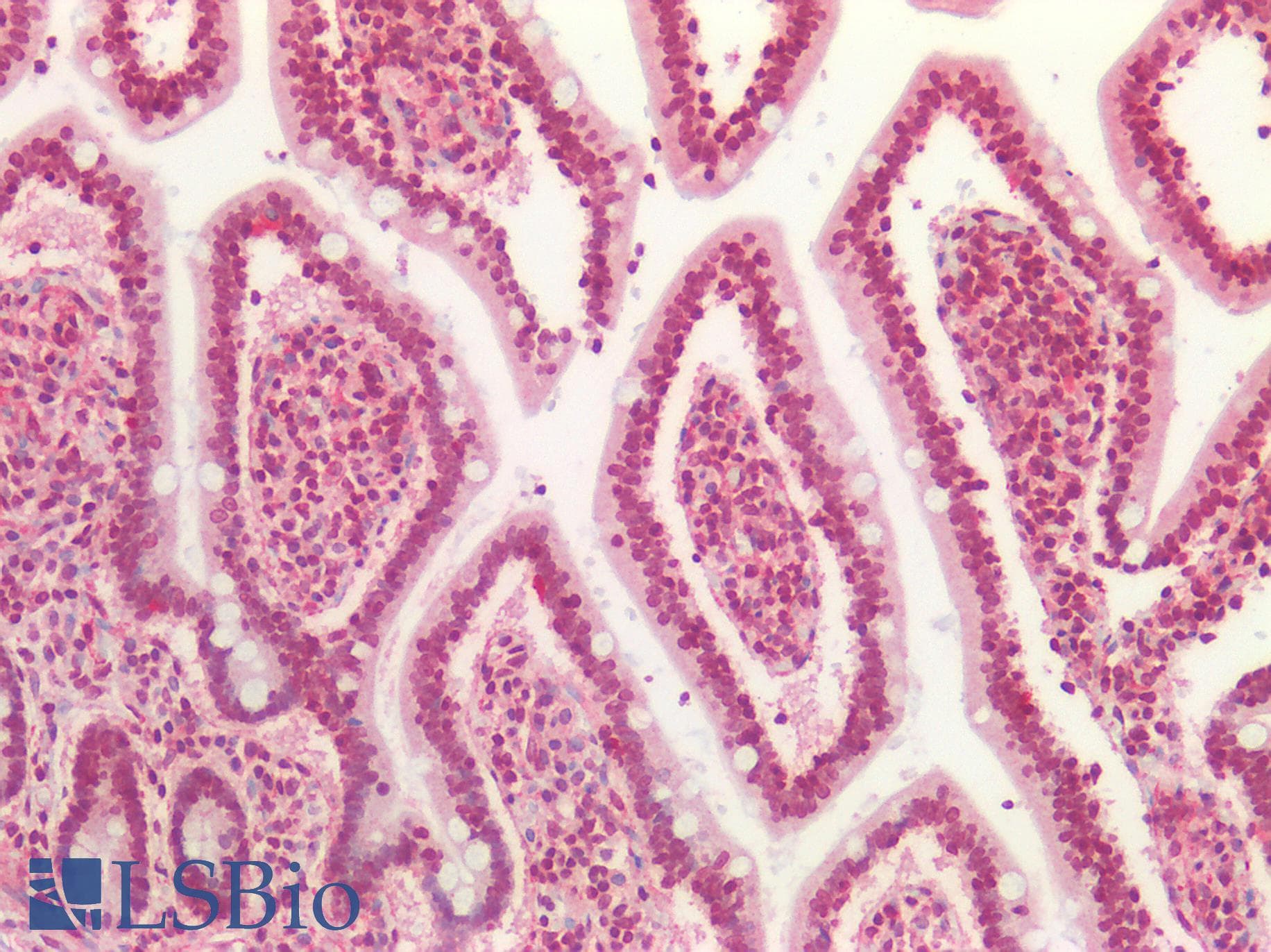 IHC-plus™ Polyclonal Rabbit anti-Human TP53 / p53 Antibody (IHC)
