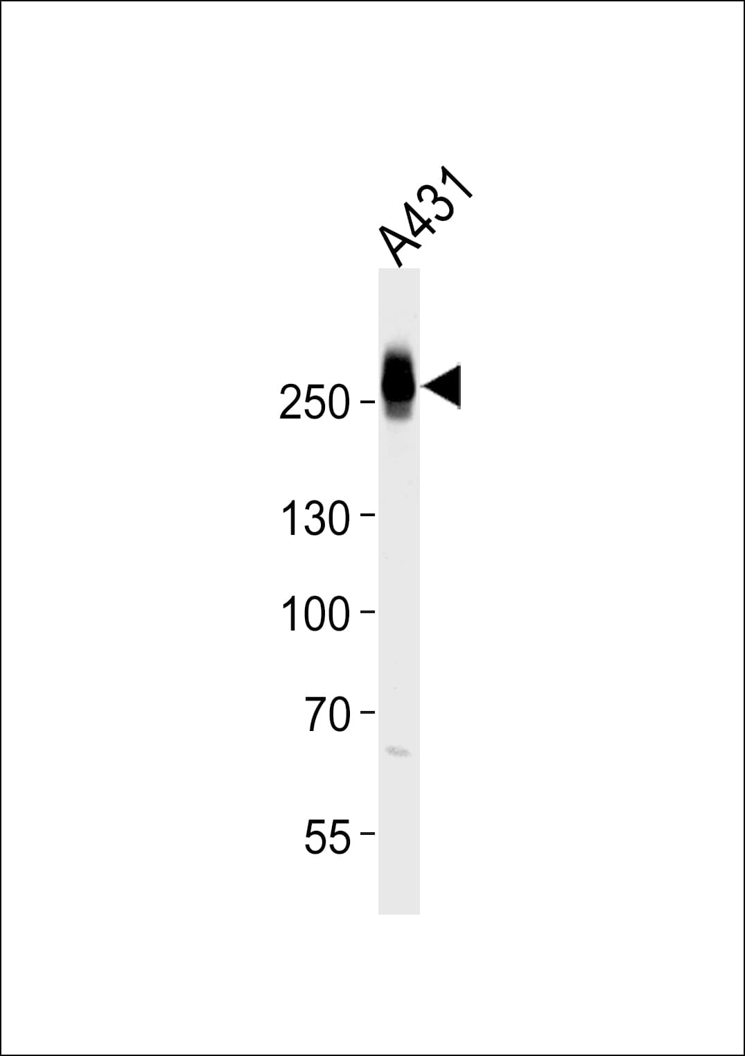 IHC-plus™ Polyclonal Rabbit anti-Human MYH14 Antibody (aa654-668, IHC, WB)