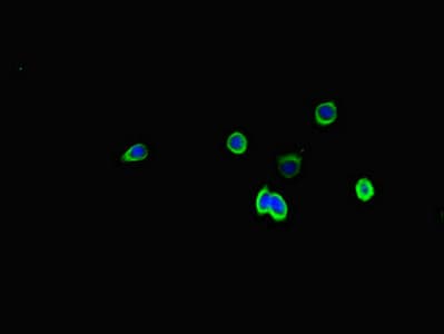 Polyclonal Rabbit anti-Human SSTR2 Antibody (IHC, IF, WB)