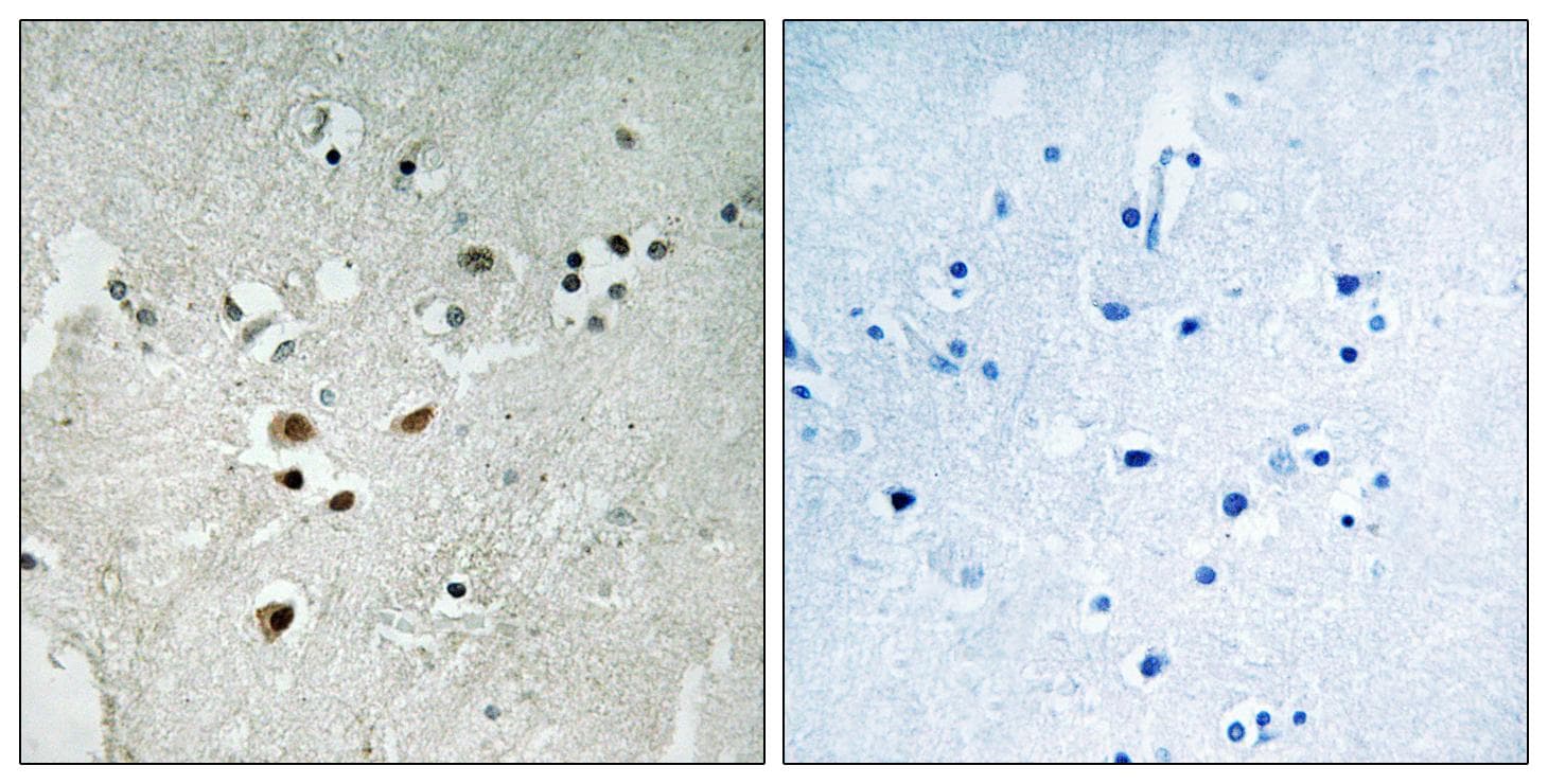 ELK3 / NET Antibody (phospho-Ser357)