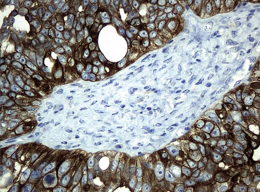 KRT19 / CK19 / Cytokeratin 19 Antibody (aa240-390, clone UMAB2)