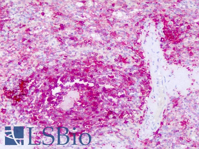 IHC-plus™ Monoclonal Mouse anti-Human HLA-DR Antibody (clone LN-3, Concentrated, IHC)
