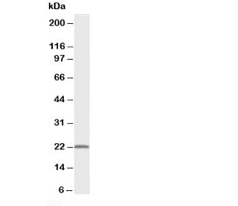 Polyclonal Rabbit anti-Human PMVK Antibody (aa135-151, IHC, WB)