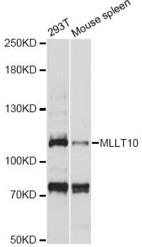 Polyclonal Rabbit anti-Human MLLT10 Antibody (WB)