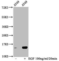 HIST1H2BN Antibody (phospho-Ser14)