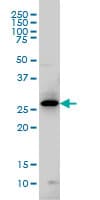 Monoclonal Mouse anti-Human GTPCH1 / GCH1 Antibody (clone 4A12, WB)