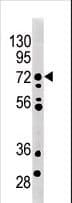 MELK Antibody (aa201-230)