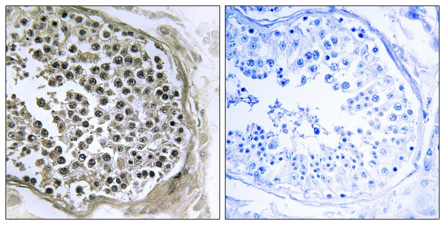 Polyclonal Rabbit anti-Human R3HCC1L / C10orf28 Antibody (IHC, WB)