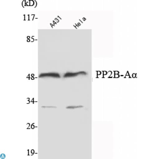 PPP3CA / CCN1 / Calcineurin A Antibody