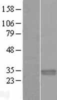PNPO Protein (Over-Expression Lysate Myc-DDK (Flag))