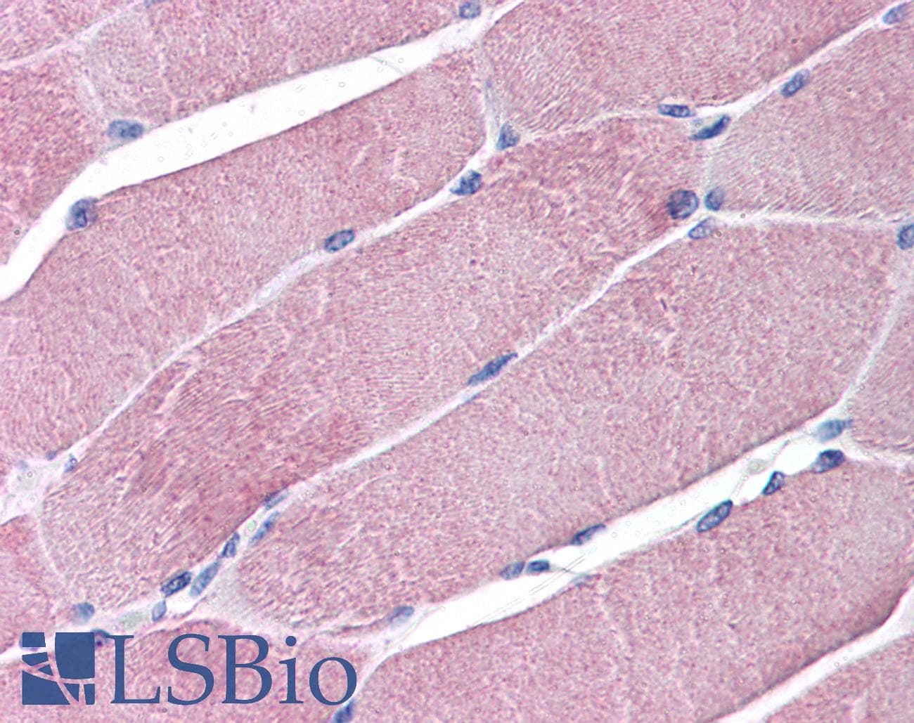 IHC-plus™ TRIM7 Antibody (aa209-221)