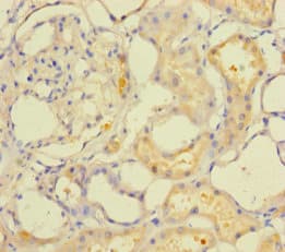 ACOT6 Antibody