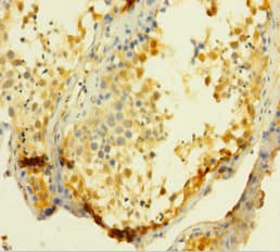 Polyclonal Rabbit anti-Human UCK1 Antibody (aa1-201)