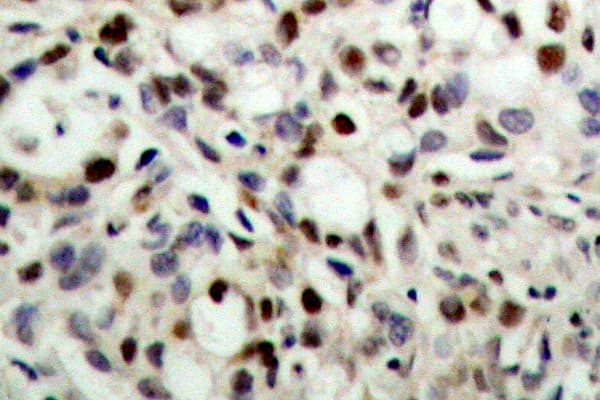 CREB1 / CREB Antibody (phospho-Ser133)