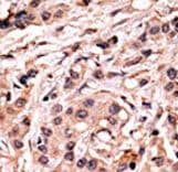 Polyclonal Rabbit anti-Human TP53 / p53 Antibody (phospho-Ser20, IHC, WB)